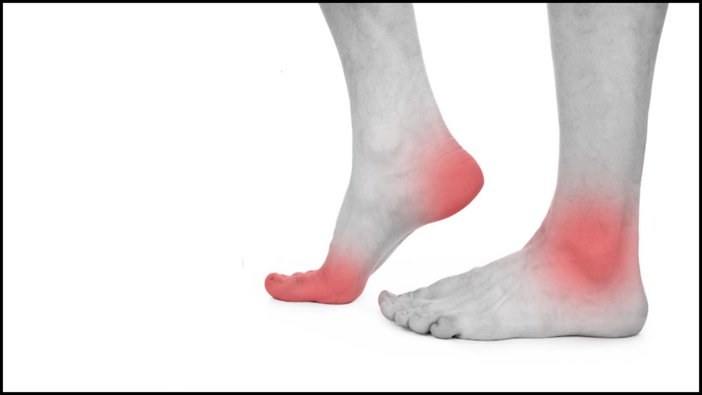 Foot and Ankle