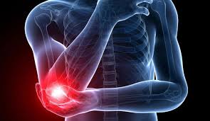 Lateral Elbow Pain and Muscle Function Impairments