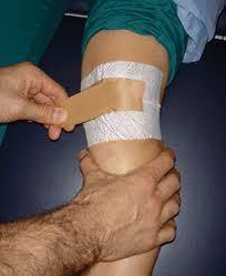 Selection of Taping Techniques for Knee Pain