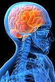 Neurological Rehabilitation