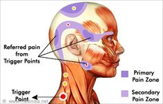 Trigger Points and Myofascial Therapy:  Referred Pain Pattern, Classifications of MFTP's and Myofascial Diagnosis