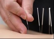 Illustrated Deep Dry Needling - A Clinical Guide