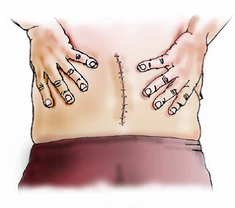 All You Ever Wanted to Know About Back Pain