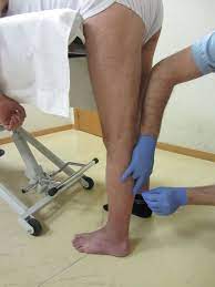 Dry Needling for Neurological Conditions