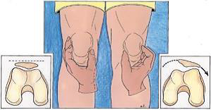 Illustrative Clinical Knee Examination: Soft Tissue Palpation