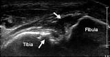 Musculoskeletal Ultrasound. Focused Impact on MRI
