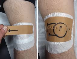 Patellar Taping: Is Clinical Success Supported by Scientific Evidence?