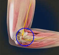 Rehab Techniques in Pain and Nerve Compression Syndrome