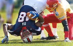 Concussion